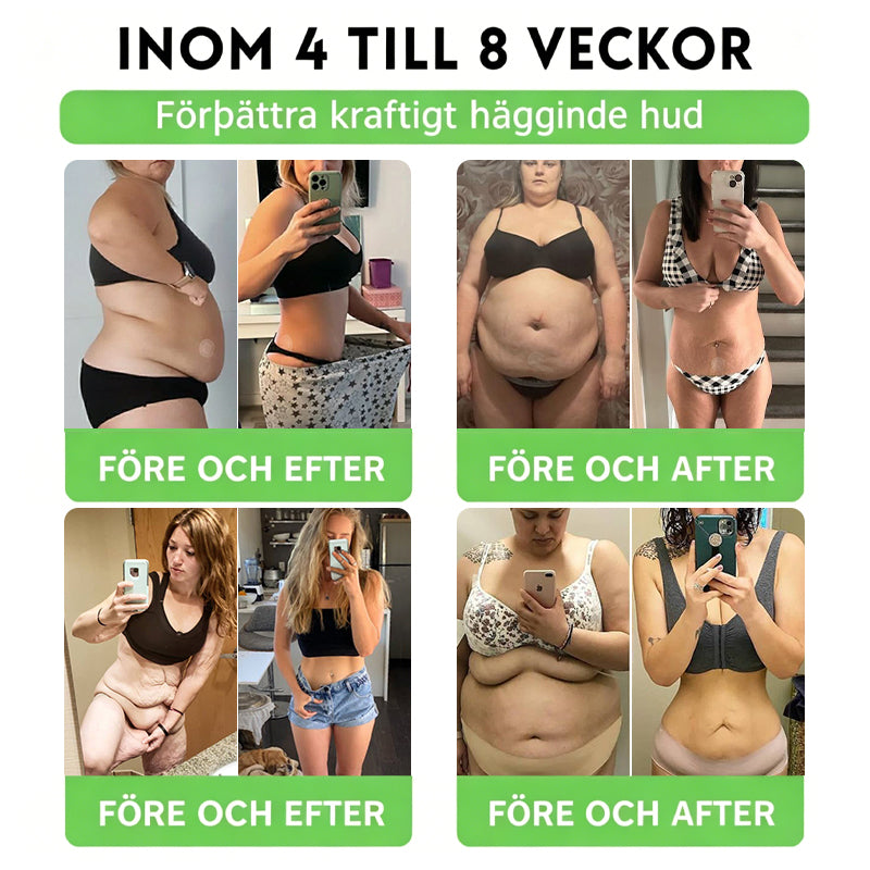 𝐀𝐌𝐙𝐊𝐄𝐄𝐏® 𝐍𝐚𝐧𝐨-𝐦𝐢𝐤𝐫𝐨𝐧å𝐥𝐬𝐩𝐥å𝐬𝐭𝐞𝐫 𝐦𝐞𝐝 𝐍𝐀𝐃+, 𝐌𝐨𝐫𝐢𝐧𝐠𝐚 𝐨𝐜𝐡 𝐁𝐞𝐫𝐛𝐞𝐫𝐢𝐧 𝐟ö𝐫 𝐀𝐌𝐏𝐊-𝐬𝐭ö𝐝 𝟏 𝐠å𝐧𝐠 𝐝𝐚𝐠𝐥𝐢𝐠𝐞𝐧, 𝐬𝐲𝐧𝐥𝐢𝐠𝐚 𝐟ö𝐫ä𝐧𝐝𝐫𝐢𝐧𝐠𝐚𝐫 𝐩å 𝟕 𝐝𝐚𝐠𝐚𝐫. 𝐒𝐭ö𝐝𝐣𝐞𝐫 𝐦𝐞𝐭𝐚𝐛𝐨𝐥𝐢𝐬𝐦, 𝐯𝐢𝐤𝐭𝐤𝐨𝐧𝐭𝐫𝐨𝐥𝐥, 𝐡𝐣ä𝐫𝐭𝐡ä𝐥𝐬𝐚, 𝐟𝐞𝐭𝐦𝐚, 𝐥ö𝐬 𝐡𝐮𝐝, 𝐝𝐢𝐚𝐛𝐞𝐭𝐞𝐬, 𝐬ö𝐦𝐧𝐚𝐩𝐧é, 𝐥𝐞𝐝𝐛𝐞𝐬𝐯ä𝐫 𝐦.𝐦.