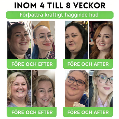 𝐀𝐌𝐙𝐊𝐄𝐄𝐏® 𝐍𝐚𝐧𝐨-𝐦𝐢𝐤𝐫𝐨𝐧å𝐥𝐬𝐩𝐥å𝐬𝐭𝐞𝐫 𝐦𝐞𝐝 𝐍𝐀𝐃+, 𝐌𝐨𝐫𝐢𝐧𝐠𝐚 𝐨𝐜𝐡 𝐁𝐞𝐫𝐛𝐞𝐫𝐢𝐧 𝐟ö𝐫 𝐀𝐌𝐏𝐊-𝐬𝐭ö𝐝 𝟏 𝐠å𝐧𝐠 𝐝𝐚𝐠𝐥𝐢𝐠𝐞𝐧, 𝐬𝐲𝐧𝐥𝐢𝐠𝐚 𝐟ö𝐫ä𝐧𝐝𝐫𝐢𝐧𝐠𝐚𝐫 𝐩å 𝟕 𝐝𝐚𝐠𝐚𝐫. 𝐒𝐭ö𝐝𝐣𝐞𝐫 𝐦𝐞𝐭𝐚𝐛𝐨𝐥𝐢𝐬𝐦, 𝐯𝐢𝐤𝐭𝐤𝐨𝐧𝐭𝐫𝐨𝐥𝐥, 𝐡𝐣ä𝐫𝐭𝐡ä𝐥𝐬𝐚, 𝐟𝐞𝐭𝐦𝐚, 𝐥ö𝐬 𝐡𝐮𝐝, 𝐝𝐢𝐚𝐛𝐞𝐭𝐞𝐬, 𝐬ö𝐦𝐧𝐚𝐩𝐧é, 𝐥𝐞𝐝𝐛𝐞𝐬𝐯ä𝐫 𝐦.𝐦.
