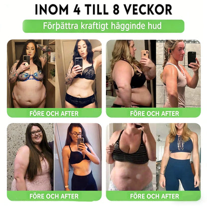 𝐀𝐌𝐙𝐊𝐄𝐄𝐏® 𝐍𝐚𝐧𝐨-𝐦𝐢𝐤𝐫𝐨𝐧å𝐥𝐬𝐩𝐥å𝐬𝐭𝐞𝐫 𝐦𝐞𝐝 𝐍𝐀𝐃+, 𝐌𝐨𝐫𝐢𝐧𝐠𝐚 𝐨𝐜𝐡 𝐁𝐞𝐫𝐛𝐞𝐫𝐢𝐧 𝐟ö𝐫 𝐀𝐌𝐏𝐊-𝐬𝐭ö𝐝 𝟏 𝐠å𝐧𝐠 𝐝𝐚𝐠𝐥𝐢𝐠𝐞𝐧, 𝐬𝐲𝐧𝐥𝐢𝐠𝐚 𝐟ö𝐫ä𝐧𝐝𝐫𝐢𝐧𝐠𝐚𝐫 𝐩å 𝟕 𝐝𝐚𝐠𝐚𝐫. 𝐒𝐭ö𝐝𝐣𝐞𝐫 𝐦𝐞𝐭𝐚𝐛𝐨𝐥𝐢𝐬𝐦, 𝐯𝐢𝐤𝐭𝐤𝐨𝐧𝐭𝐫𝐨𝐥𝐥, 𝐡𝐣ä𝐫𝐭𝐡ä𝐥𝐬𝐚, 𝐟𝐞𝐭𝐦𝐚, 𝐥ö𝐬 𝐡𝐮𝐝, 𝐝𝐢𝐚𝐛𝐞𝐭𝐞𝐬, 𝐬ö𝐦𝐧𝐚𝐩𝐧é, 𝐥𝐞𝐝𝐛𝐞𝐬𝐯ä𝐫 𝐦.𝐦.
